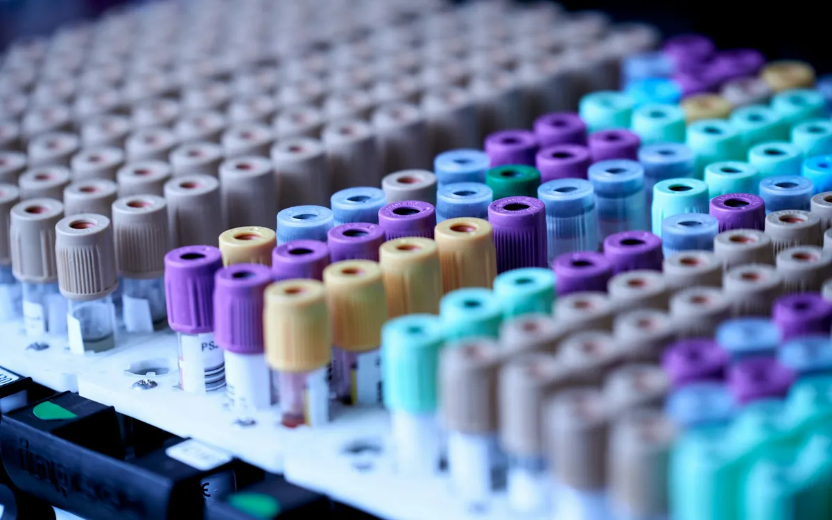 Fileiras de tubos de coleta de sangue com tampas coloridas em um laboratório