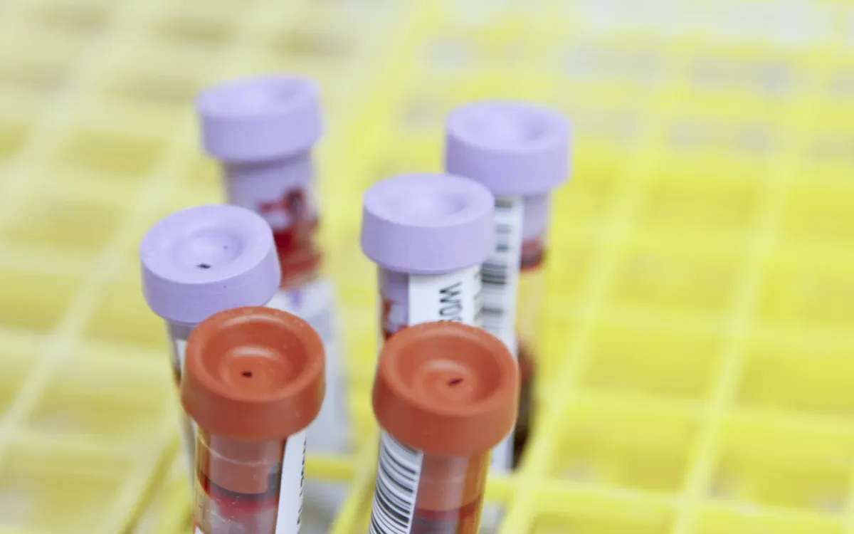 Tubos de coleta de sangue com tampas coloridas em uma estante