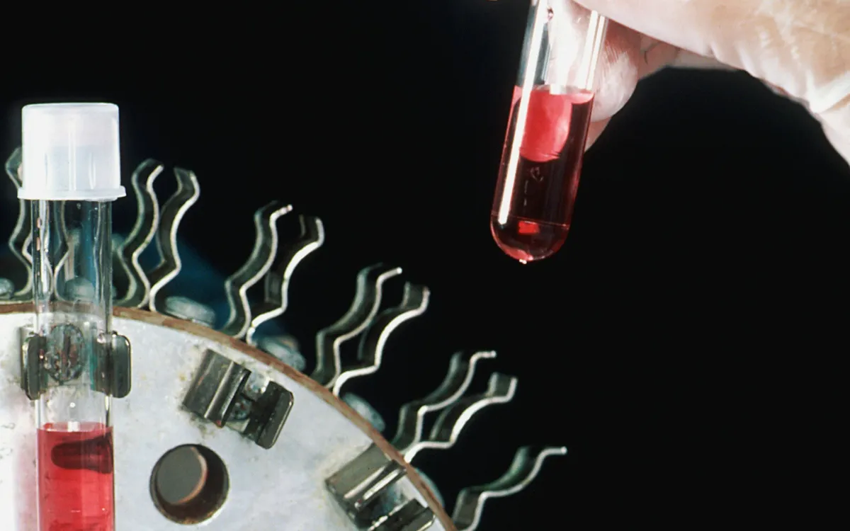 Mão com luva segurando um tubo de ensaio com amostra de sangue em um laboratório